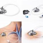 Implantable Venous Access Port System