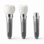 Dental Implant System